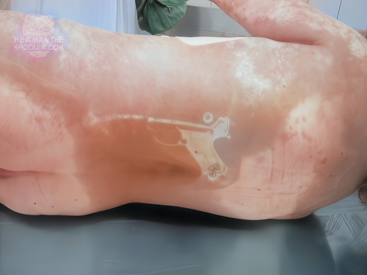Contact blanching on the back of the body depicting a pistol