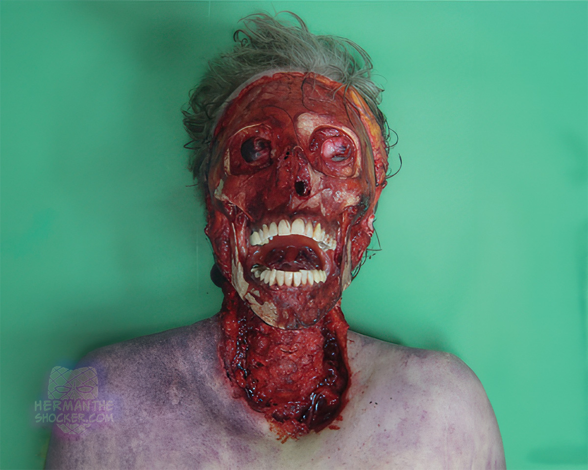 Postmortem injuries inflicted by a domestic dog
