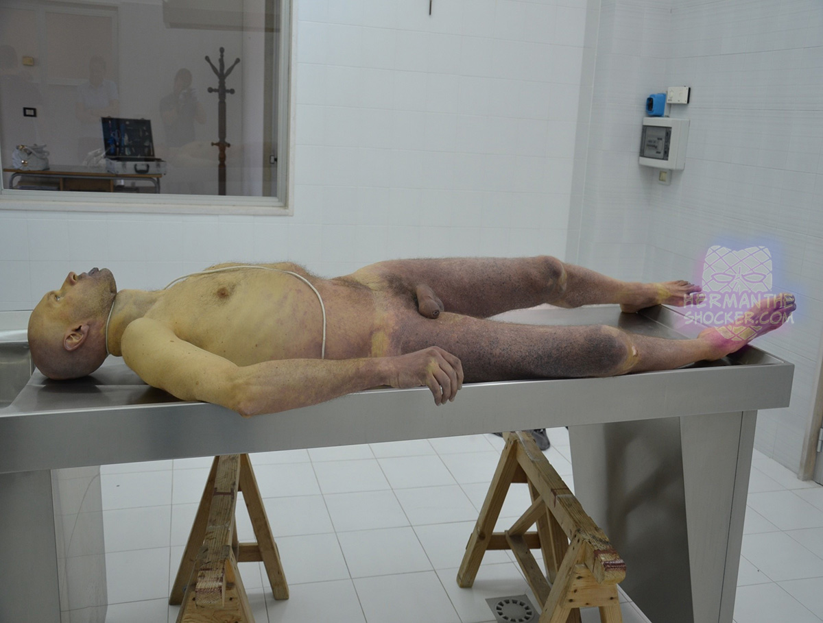 Body of a man who committed suicide by hanging