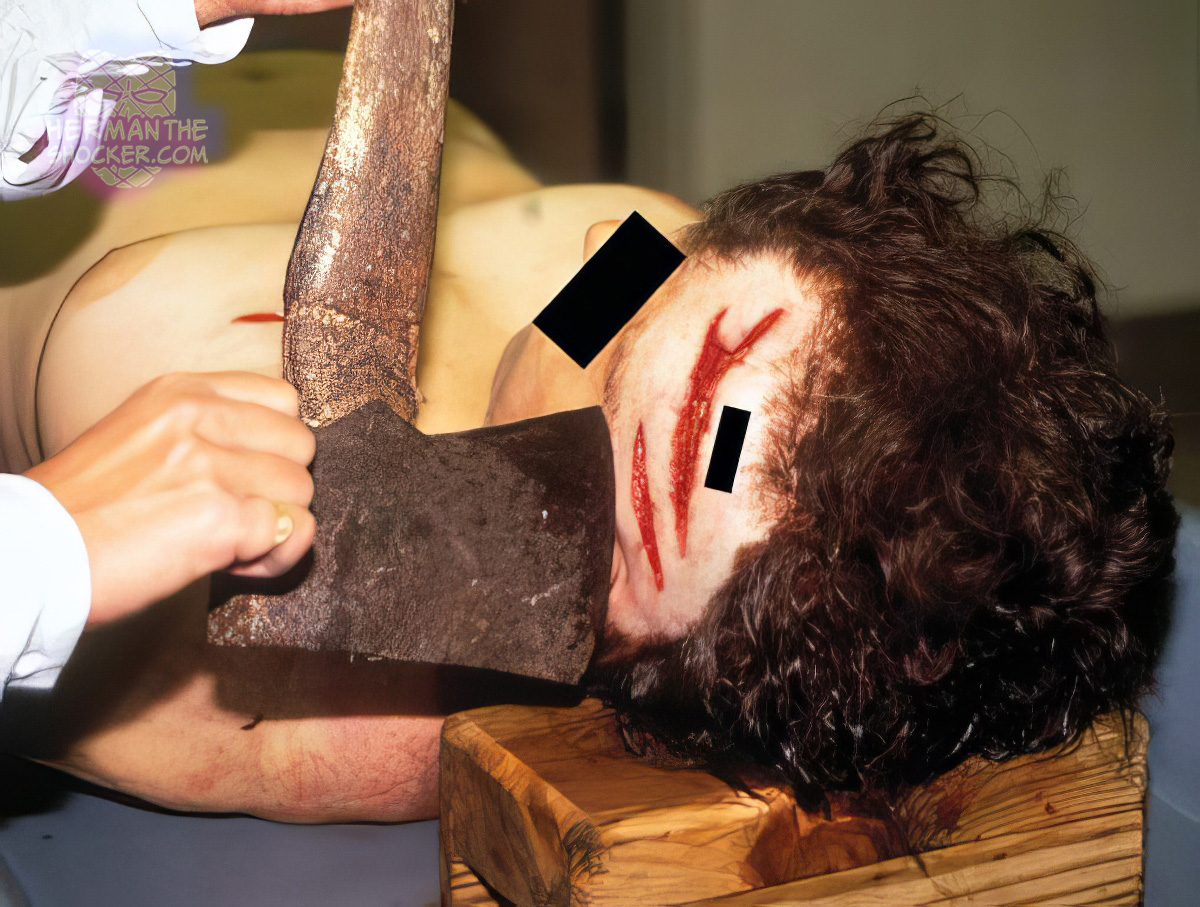 Fatal chop wounds on the side of the head from an axe