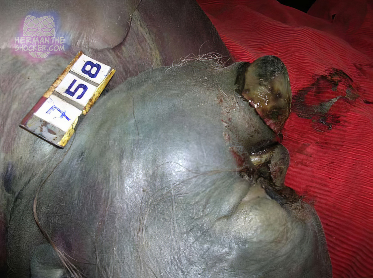 Protrusion of the tongue on this decomposing individual
