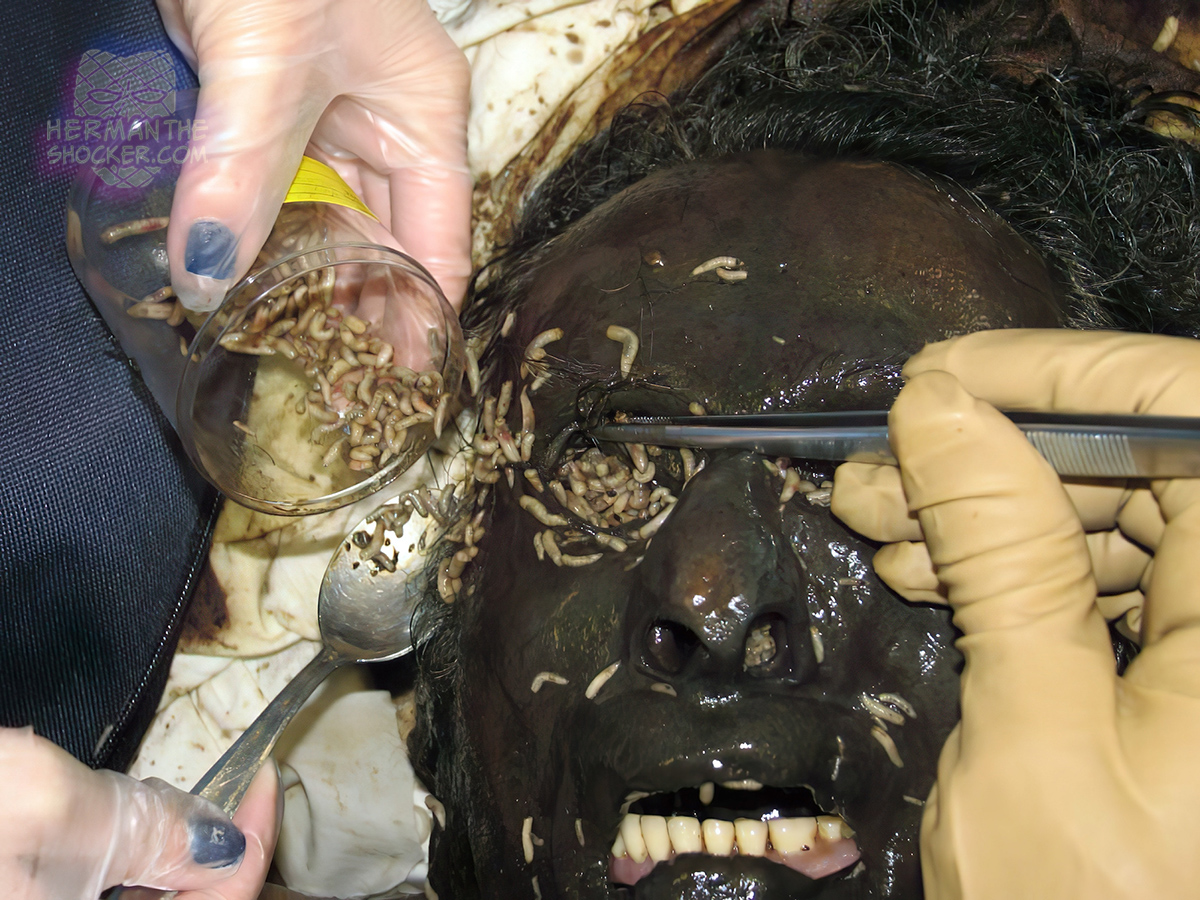 Diptera larvae collected from the ocular cavity of a cadaver