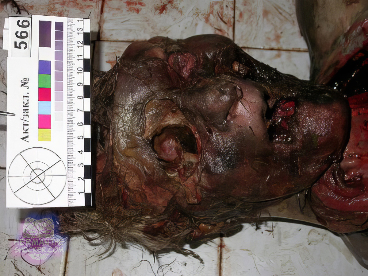 Putrefaction of a body