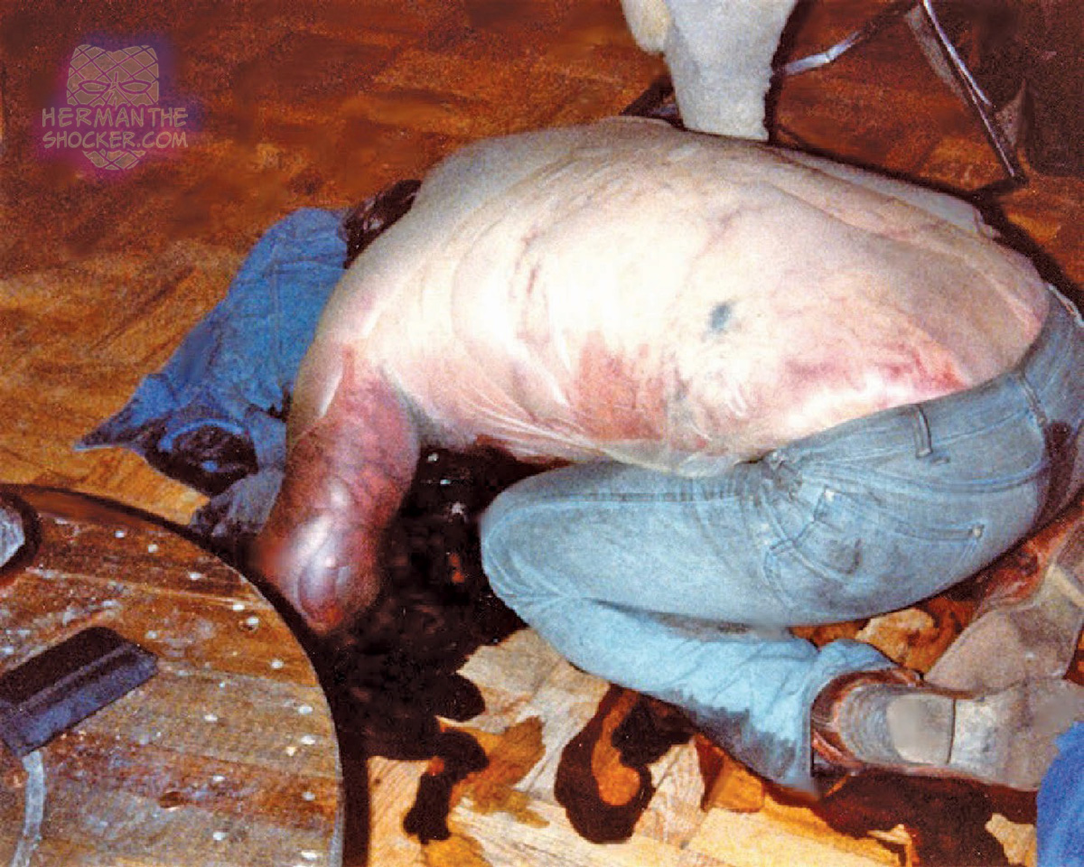 Bloating and decompositional blisters