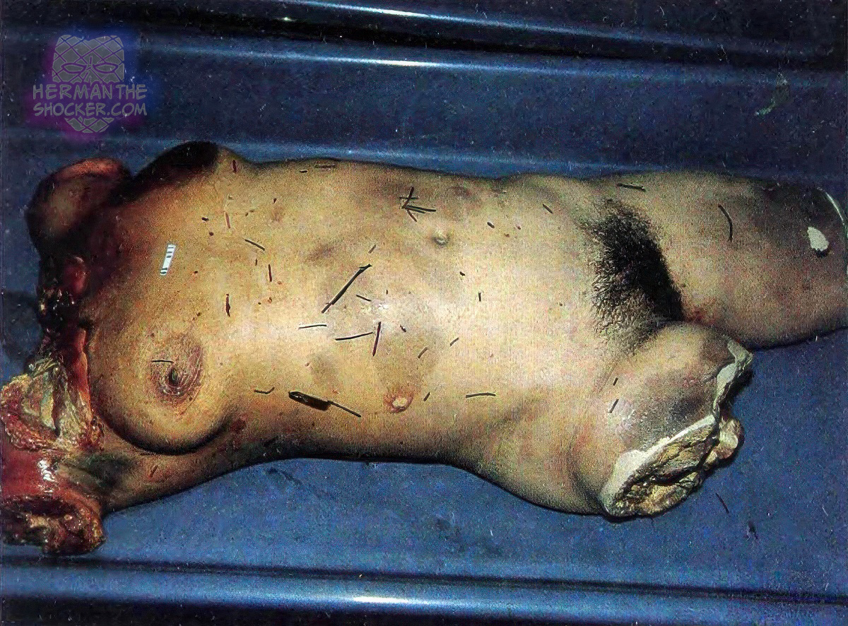 Dismembered torso