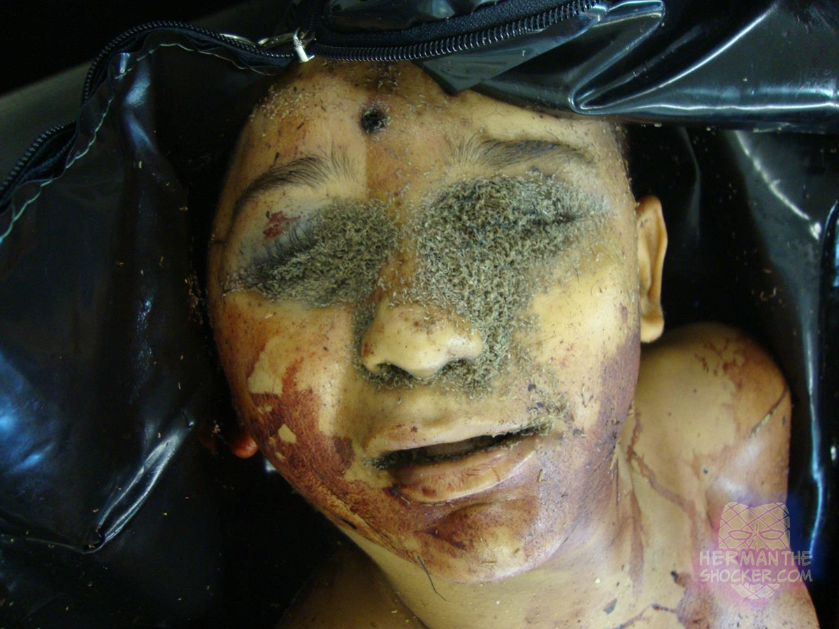 Maggot mass on corpse’s face